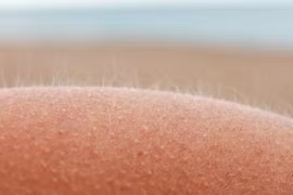 Lông tơ đào (lông măng) được phát hiện từ hơn 100 năm trước có liên quan mật thiết đến cơ chế gây ngứa.