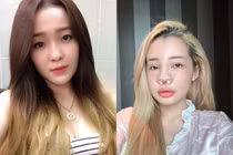 10 năm qua, Ngân 98 từng 'nghiện' phẫu thuật thẩm mỹ ra sao?