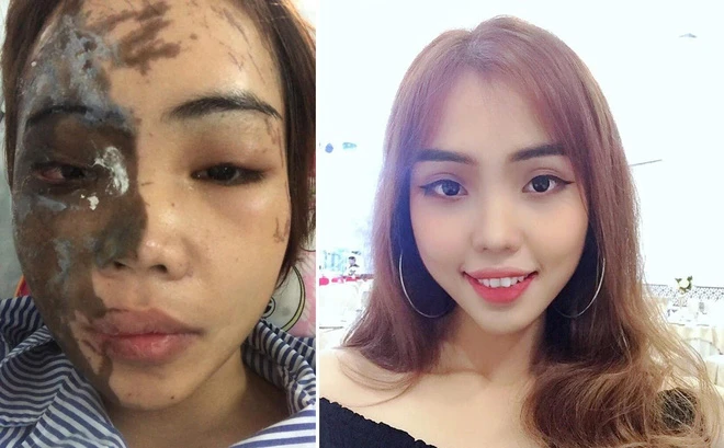 Những vụ cuồng ghen sát hại vợ, người yêu chấn động