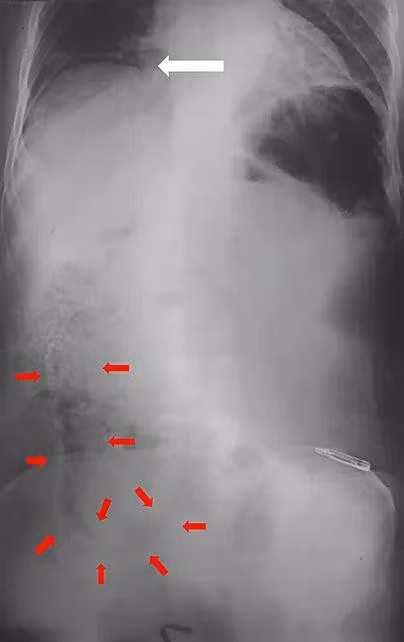 xrayscan-editedjpg.jpg