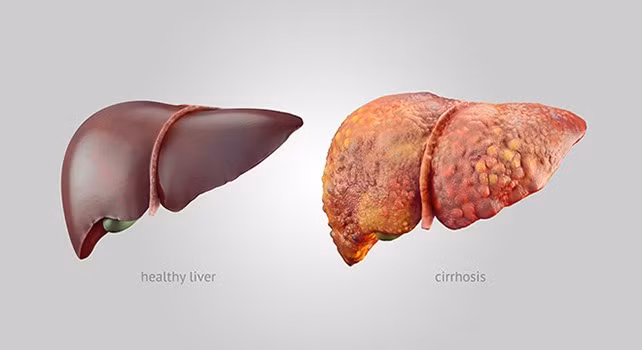 damagedliver.jpg