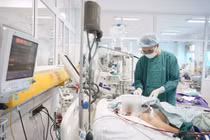 Sau 4 ngày sốt, người bệnh 77 tuổi suy hô hấp nặng do viêm phổi