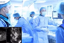 Lần đầu tại Việt Nam: Điều trị lạc nội mạc tử cung bằng sóng cao tần