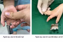 Cứu bé 4 tuổi kẹt tay trong ống sắt