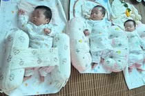 10 ngày sản phụ mang tam thai mổ lấy thai, viêm ruột thừa, xoắn phần phụ