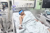 Kịp thời cứu sống trẻ 14 tuổi vừa mắc sốt xuất huyết vừa viêm ruột thừa cấp