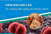 Viêm não mô cầu dấu hiệu giống cảm cúm, cách gì phân biệt?