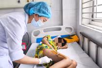 Bé trai 11 tuổi nguy kịch vì tụ cầu vàng phá hủy xương đùi