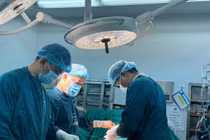 Phát hiện ung thư thực quản tình cờ qua nội soi trước mổ ung thư gan