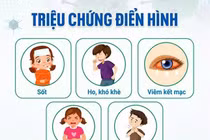 Adenovirus tăng gấp 3 lần: Nguy cơ lây chéo tại bể bơi mùa hè