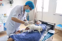 Xử lý bỏng sai nguy hại khôn lường
