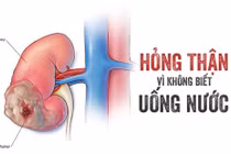 Bác sĩ cảnh báo nguy cơ tổn thương thận trong mùa hè vì uống nước sai cách