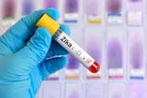 Phát hiện thêm 1 trong 2 phụ nữ Việt nhiễm Zika đang mang thai