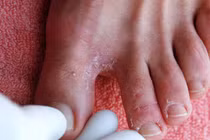  Những căn bệnh đáng sợ dễ mắc khi đi bơi 