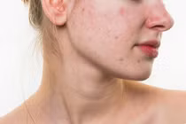 6 dấu hiệu stress trầm trọng, báo hiệu cơ thể cần nghỉ ngơi
