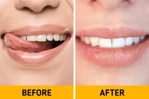 10 điều kỳ lạ có thể xảy ra với cơ thể bạn vào mùa đông