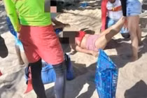 Bị quả dừa rơi trúng đầu khi tắm nắng, nữ du khách bị thương nặng