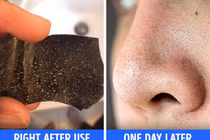 6 điều cần biết trước khi dùng miếng lột mụn đầu đen