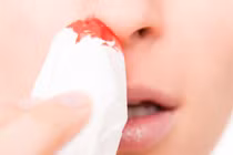 Thu hanh khô, chảy máu mũi tưởng đơn giản ai ngờ ung thư