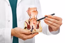 Bệnh trĩ gây biến chứng nguy hiểm: Phòng ngừa thế nào?