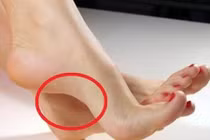 5 nét tướng ở bàn chân báo hiệu bạn sắp giàu to