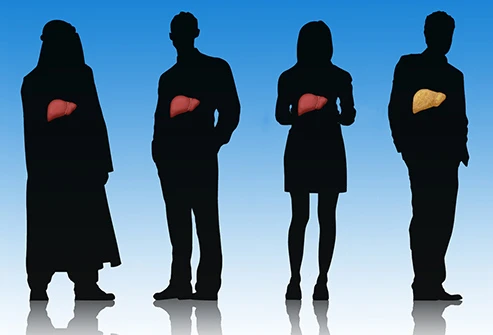 Gan nhiễm mỡ mới chớm cũng rất nguy hiểm: Triệu chứng cần đi khám ngay