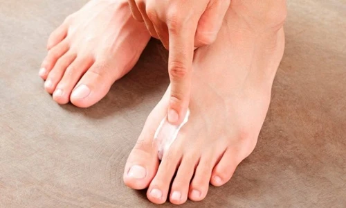 Đề phòng 5 bệnh về da cứ đến mùa hè, thi nhau ghé thăm