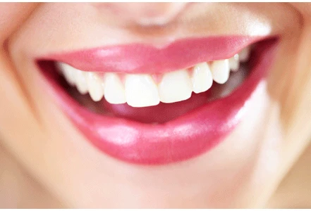 3 bí quyết tẩy răng trắng tinh tại nhà