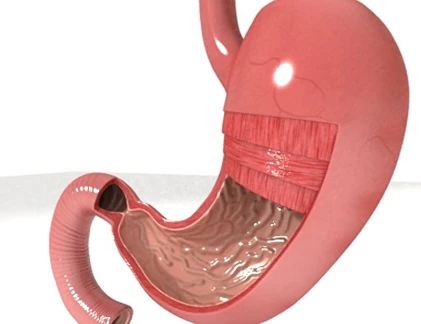 Bí quyết phòng viêm dạ dày hiệu quả