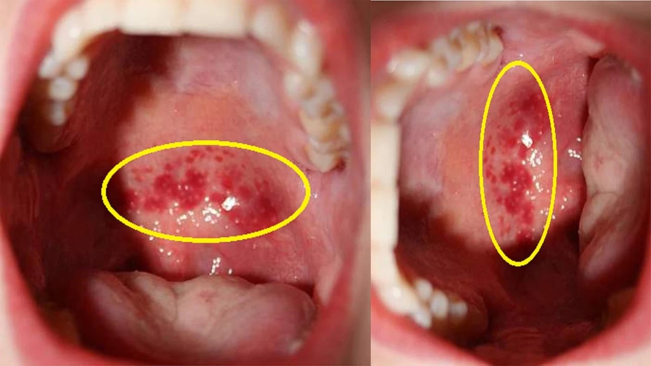 Các bài thuốc dân gian trị những loại bệnh có “hạt”