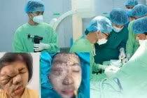 Cô gái trẻ thoát khỏi khối u khổng lồ sau 17 năm sống chung