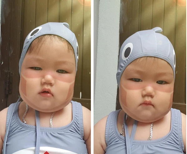 Phát sốt với em bé bị cháy nắng, in hình khẩu trang trên mặt