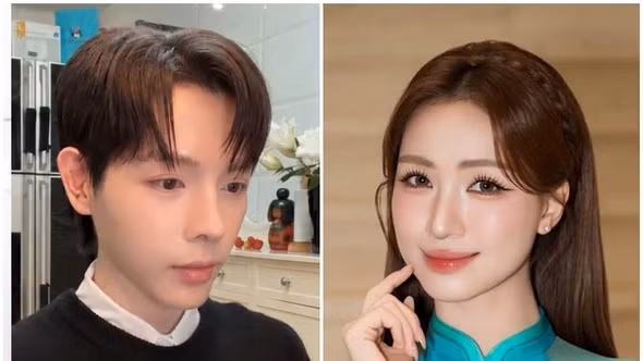 Hòa Minzy phản ứng ra sao khi Đức Phúc phẫu thuật thẩm mỹ lần 2?