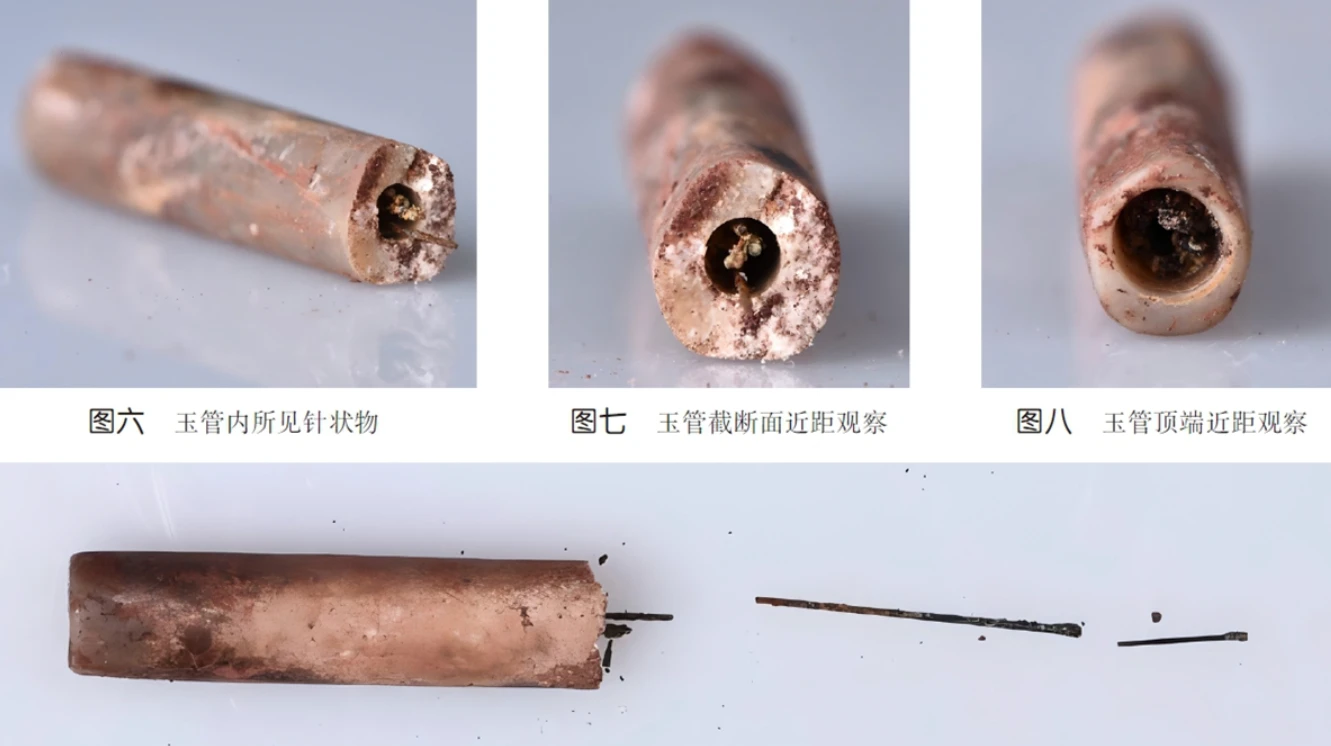 Bất ngờ phát hiện kim châm cứu bằng thép cổ nhất thế giới 
