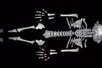 Chuyên gia lý giải trẻ em Neanderthal lớn nhanh hơn người hiện đại