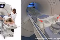 Phát triển phương pháp mới ứng dụng AI trong chẩn đoán ung thư