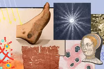 Phát triển công nghệ nano mới trong điều trị vết thương mãn tính