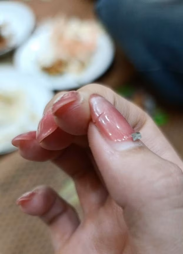 Nếu trước Tết là “đại hội làm nail” thì sau Tết lại rộ lên “đại hội tháo móng”. Trên mạng xã hội, nhiều chị em đăng ảnh đôi tay ngay sau khi gỡ lớp gel, lớp móng úp. Bề mặt móng lúc này thường xuất hiện những mảng trắng sần, dấu vết rõ rệt của keo và sơn vừa được loại bỏ. Nhìn vào là biết ngay hành trình dưỡng móng sắp bắt đầu để móng khỏe và bóng trở lại.