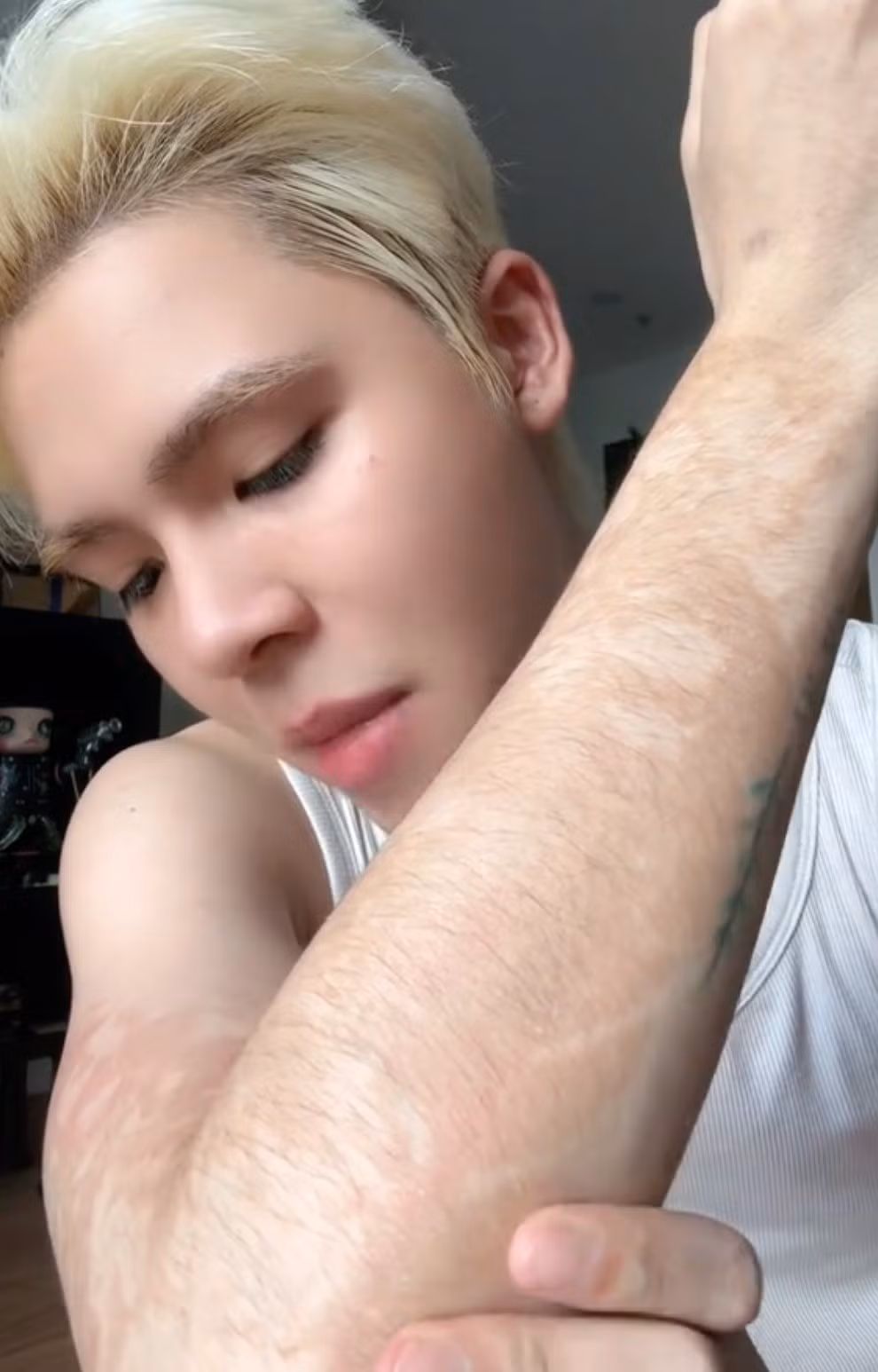 Ngày 16/10, TikToker Huỳnh Khánh Đông tiếp tục đăng tải đoạn video "cầu cứu" cộng đồng mạng về vết dị ứng trên cánh tay do hình xăm dán tạm thời từ 2 tuần trước đó.