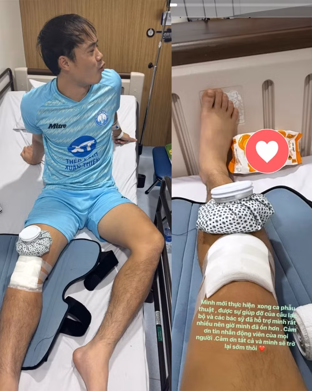 Nguyễn Văn Toàn, tiền đạo được đánh giá cao với tốc độ và sự lắt léo, đã gặp chấn thương sụn chêm đầu gối. Chấn thương này kéo dài từ AFF Cup 2024 và tái phát nhiều lần, khiến anh phải điều trị dứt điểm.