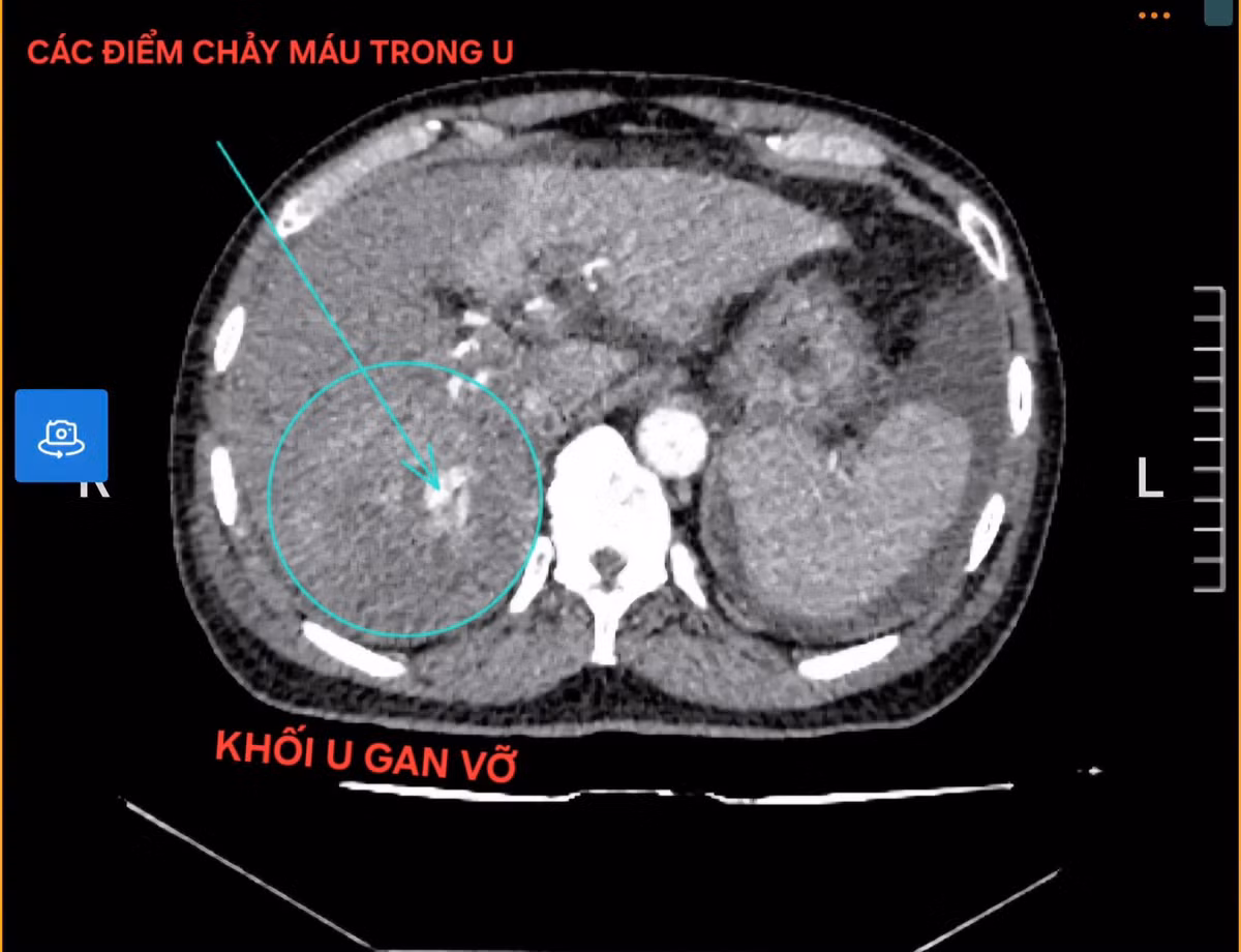 vo-gan1.jpg