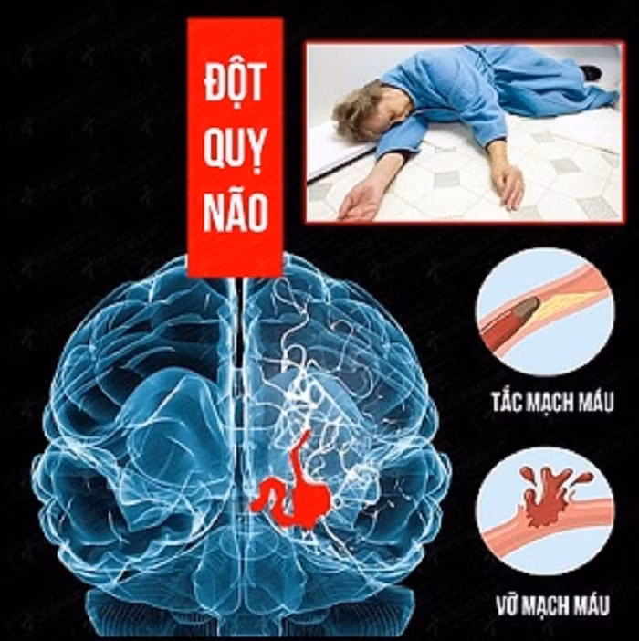 dot-quy-nao-1.jpg
