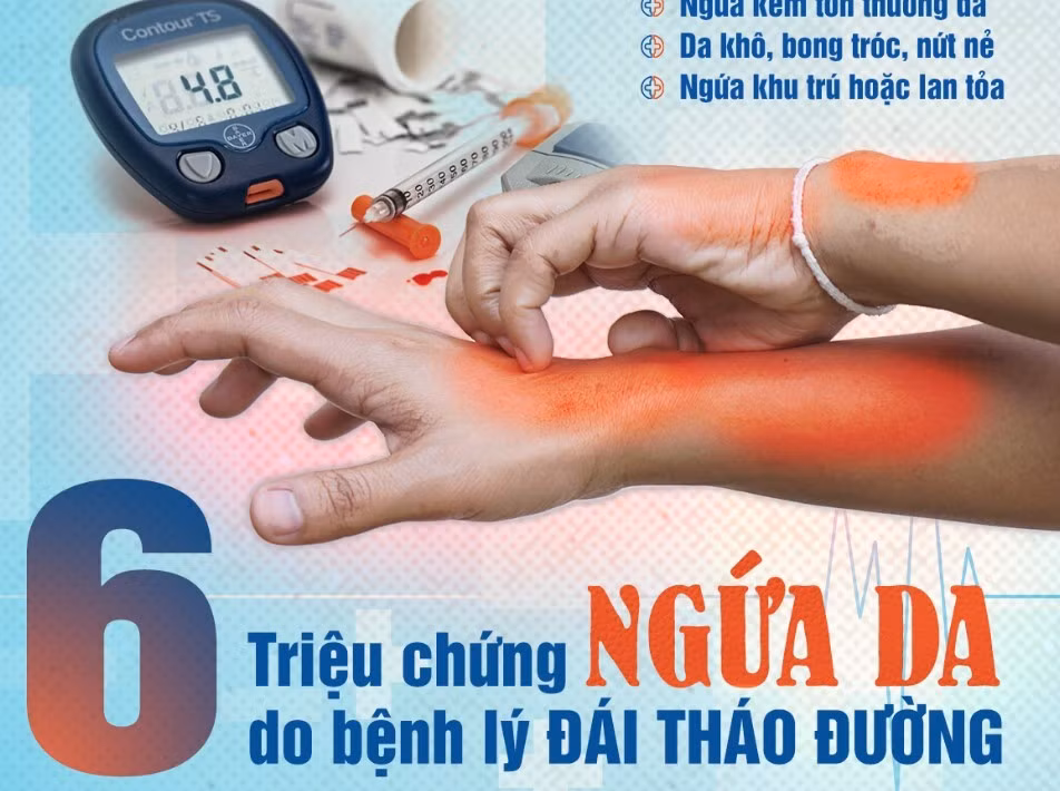 ngua-da.jpg