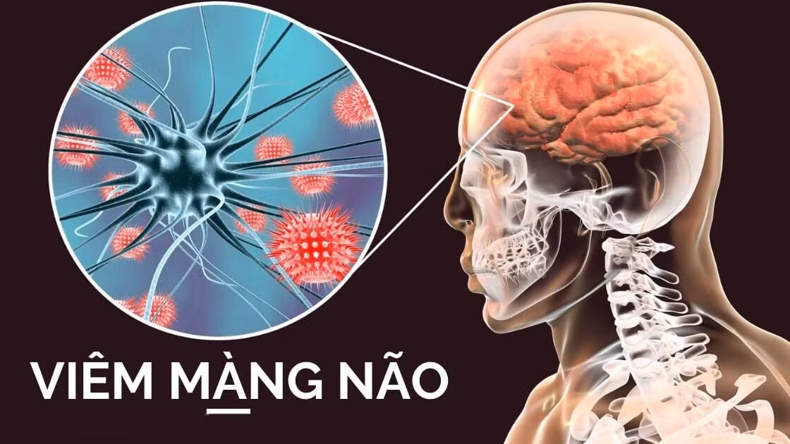 viem-mang-nao-mo-cau.jpg