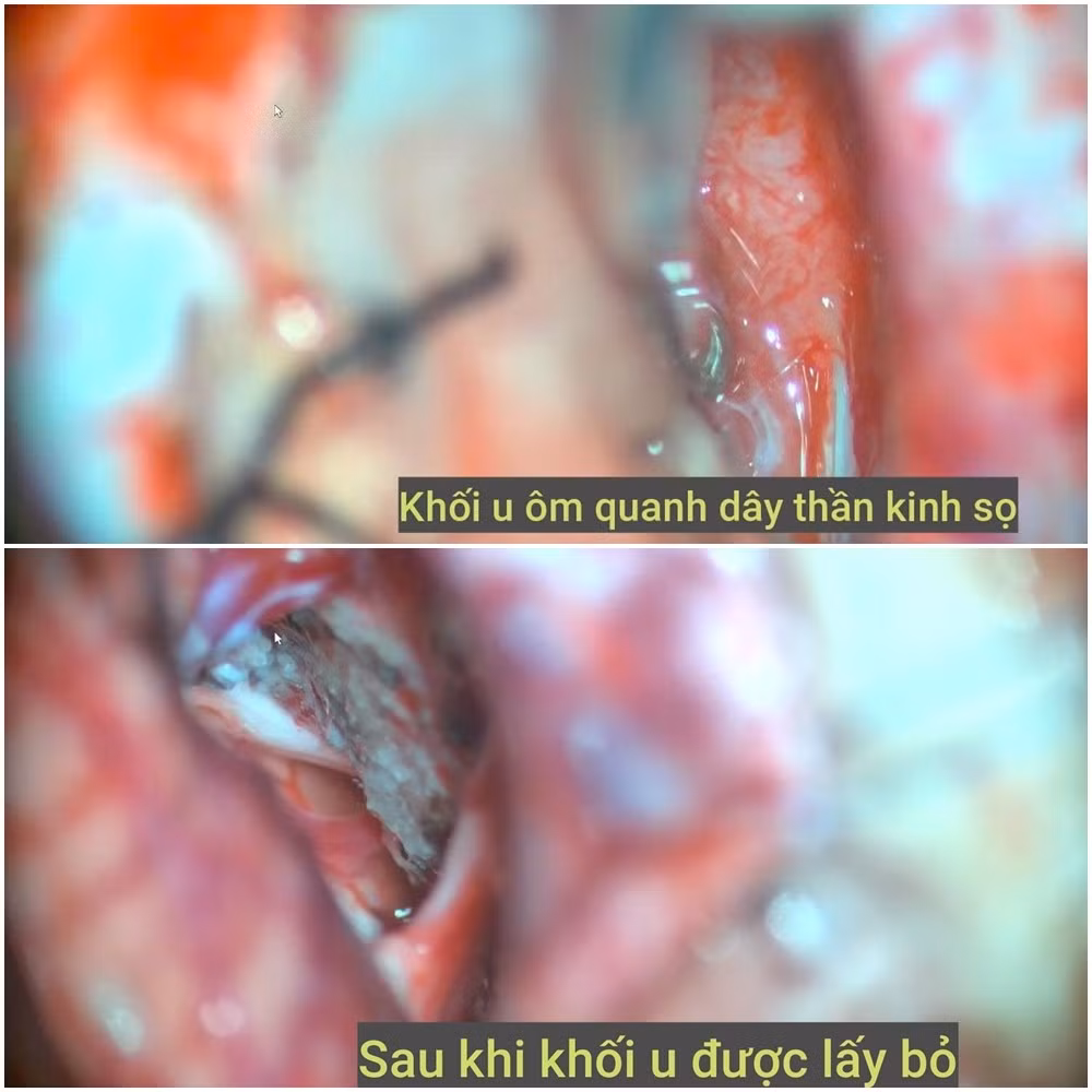 khoiugoctieucaunao-1.jpg