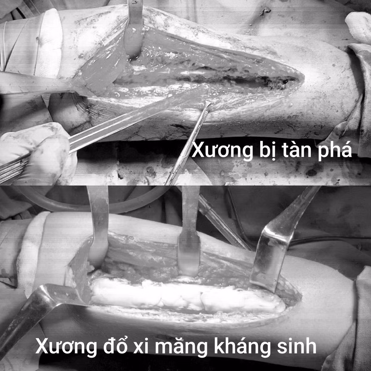 xuong-dui-2.jpg