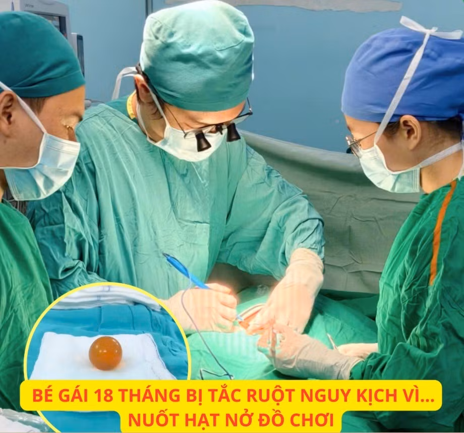 tac-ruot-vi-hat-no.jpg