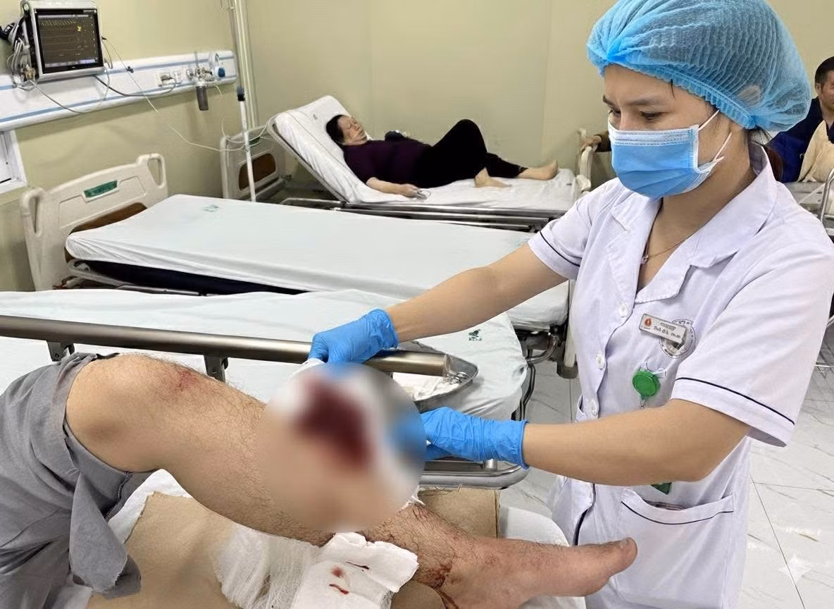vet-thuong.jpg