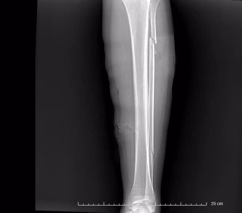 vet-thuong-1.jpg