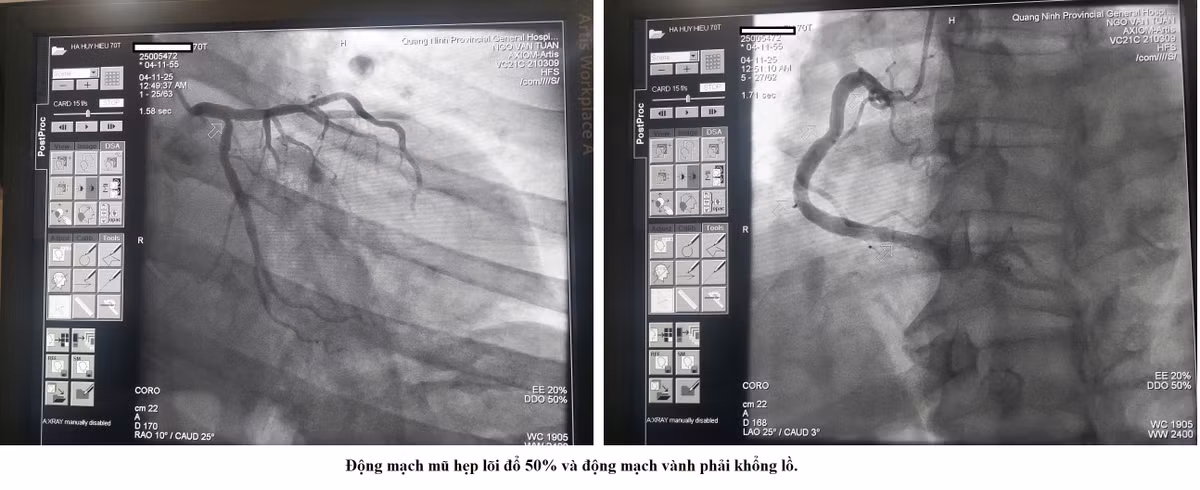 hep-khit-1.jpg